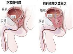 尿等待