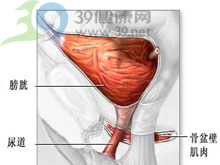 排尿不畅
