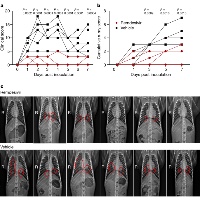 COVID-19 新型コロナウイルス