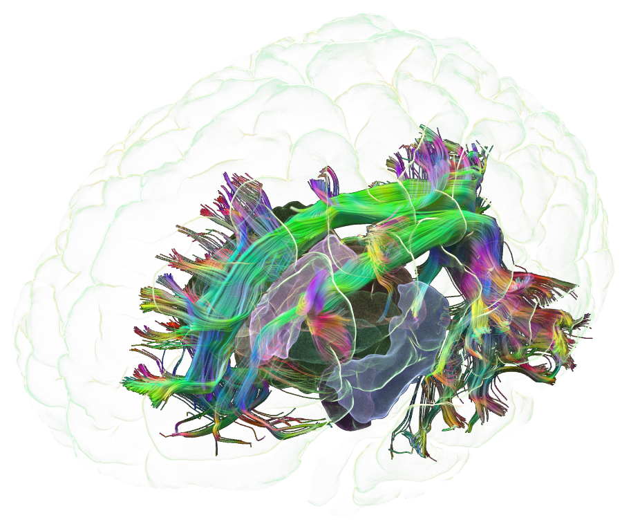 Brain Image