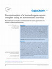 Research paper thumbnail of Reconstruction of a burned nipple-areola complex using an autonomized star flap