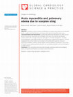 Research paper thumbnail of Acute myocarditis and pulmonary edema due to scorpion sting