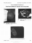 Research paper thumbnail of Giant Macroorchidism in Congenital Adrenal Hyperplasia