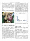 Research paper thumbnail of A NOVEL LARYNGOSCOPE SENSOR TO PREVENT DENTAL DAMAGE DURING LARYNGOSCOPY AND INTUBATION