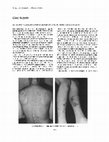 Research paper thumbnail of Cutaneous Vasculitis After Intermediate Dose of Methotrexate (Idmtx)