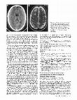 Research paper thumbnail of Progression of cerebral white matter hyperintensities is related to leucocyte gene expression