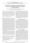 Research paper thumbnail of Computed Tomography Imaging Manifestations of Commonly Used Materials in Posttraumatic Craniofacial Repair