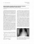 Research paper thumbnail of Massive pericardial hematoma simulating constrictive pericarditis: a complication of radiofrequency catheter ablation