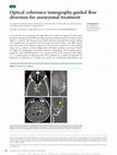 Research paper thumbnail of Optical coherence tomography-guided flow diversion for aneurysmal treatment