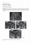 Research paper thumbnail of Pancreatic lipoma