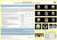 Research paper thumbnail of Plagiocephaly and Torticollis of three individuals from a Kurgan, Scythian Period, in Mayemer, Kazakhstan