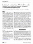 Research paper thumbnail of Evaluating the periapical status of teeth with irreversible pulpitis by using cone-beam computed tomography scanning and periapical radiographs