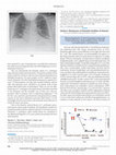 Research paper thumbnail of Paraneoplastic Erythropoietin-Induced Polycythemia Associated With Small Lymphocytic Lymphoma