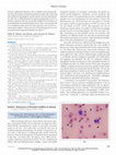 Research paper thumbnail of Intravascular hemolysis as a complication of clostridium perfringens sepsis