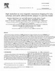 Research paper thumbnail of High resolution ex vivo magnetic resonance imaging of in situ coronary and aortic atherosclerotic plaque in a porcine model