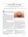 Research paper thumbnail of Nevoid keratosis of the nipple