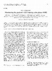 Research paper thumbnail of Monitoring the patient's EEG during echo planar MRI