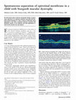 Research paper thumbnail of Spontaneous separation of epiretinal membrane in young subjects: personal observations and review of the literature