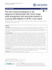 Research paper thumbnail of The role of electrocardiogram in the diagnosis of dextrocardia with mirror image atrial arrangement and ventricular position in a young adult Nigerian in Ile-Ife: a case report