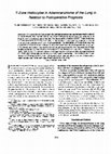 Research paper thumbnail of T-zone histiocytes in adenocarcinoma of the lung in relation to postoperative prognosis