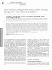 Research paper thumbnail of Gene expression profiling identifies tumour markers potentially playing a role in uveal melanoma development