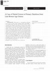 Research paper thumbnail of Tritsaroli P. 2018. A case of dental fusion in primary dentition from Late Bronze Age Greece, Balkan Journal of Dental Medicine 22 (2): 102-105