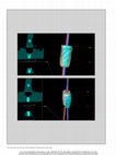 Research paper thumbnail of Accuracy of Implants Placed with Surgical Guides: Thermoplastic Versus 3D Printed