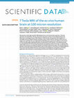 Research paper thumbnail of 7 Tesla MRI of the ex vivo human brain at 100 micron resolution