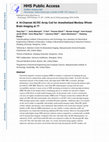 Research paper thumbnail of A 16-channel AC/DC array coil for anesthetized monkey whole-brain imaging at 7T