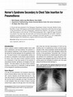 Research paper thumbnail of Horner’s Syndrome Secondary to Chest Tube Insertion for Pneumothorax