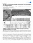 Research paper thumbnail of Three alleles in the pat-3 locus of Caenorhabditis elegans: mutations in the membrane-distal NPxY phosphotyrosine motif