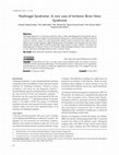 Research paper thumbnail of Nothnagel Syndrome: A rare case of Ischemic Brain Stem Syndrome