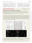 Research paper thumbnail of Split P waves: marker of extreme interatrial delay