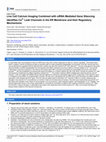 Research paper thumbnail of Live Cell Calcium Imaging Combined with siRNA Mediated Gene Silencing Identifies Ca2+ Leak Channels in the ER Membrane and their Regulatory Mechanisms