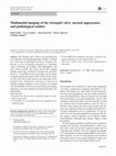 Research paper thumbnail of Multimodal imaging of the tricuspid valve: normal appearance and pathological entities