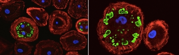 Two side-by-side slides of microscopic organisms