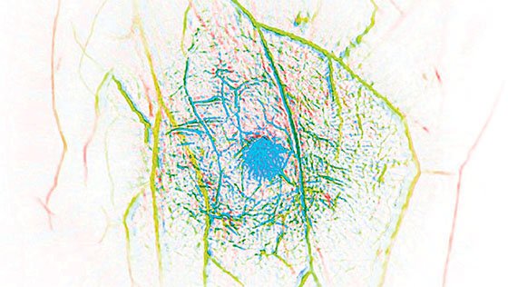 breast in vivo