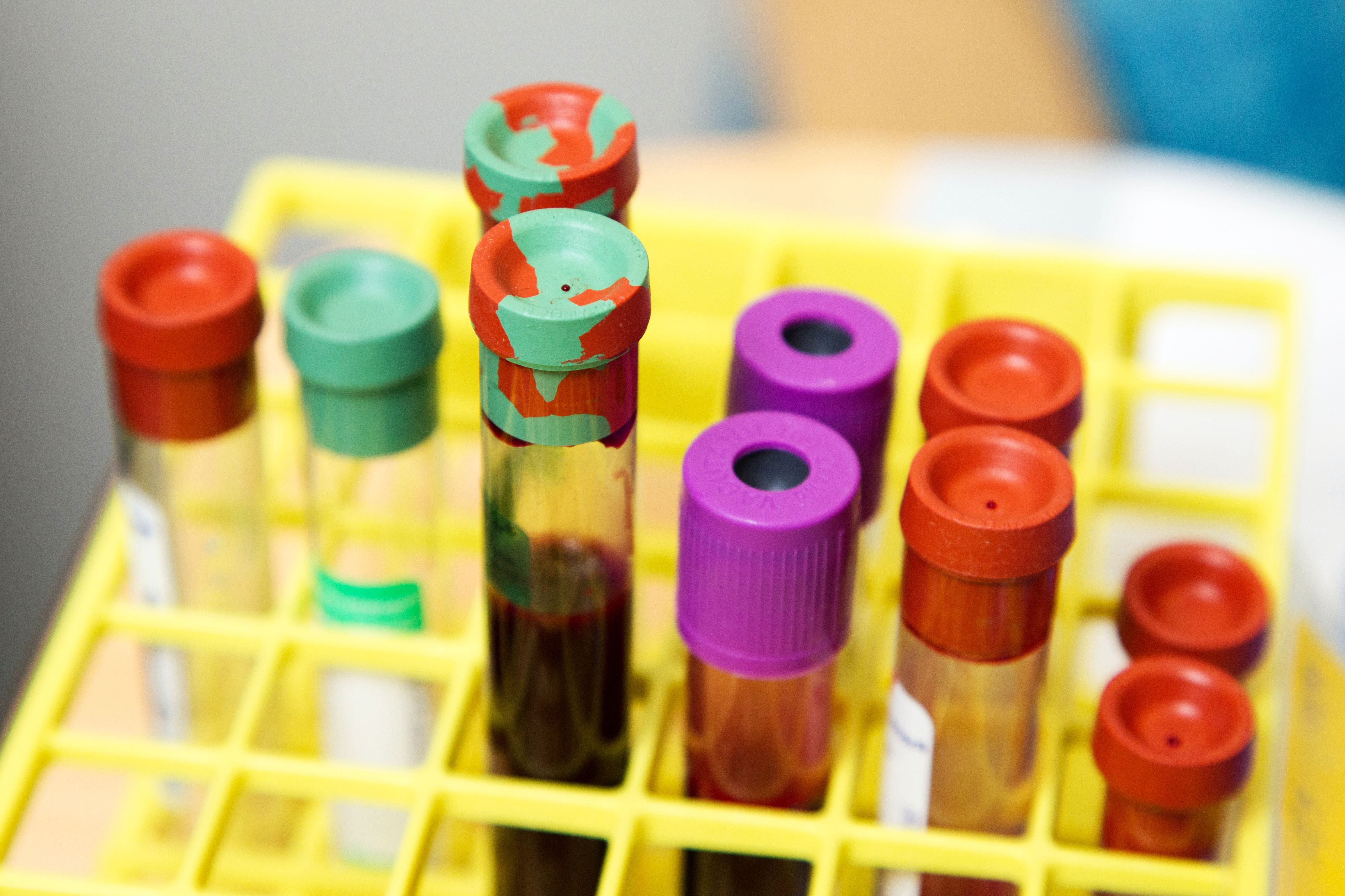 capped test tubes in container