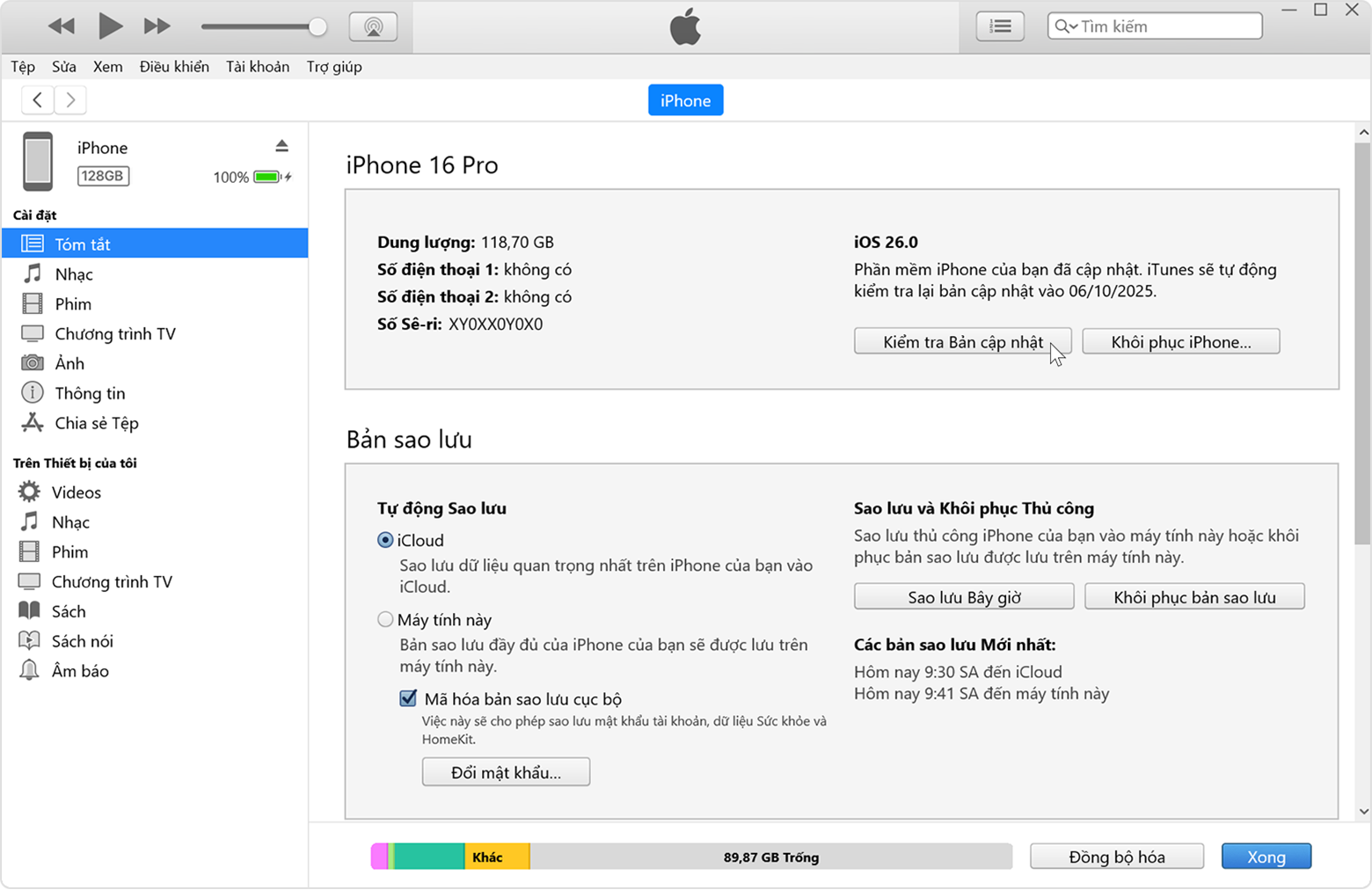 Con trỏ đang ở trên nút "Kiểm tra bản cập nhật" trong tab Tóm tắt iTunes.