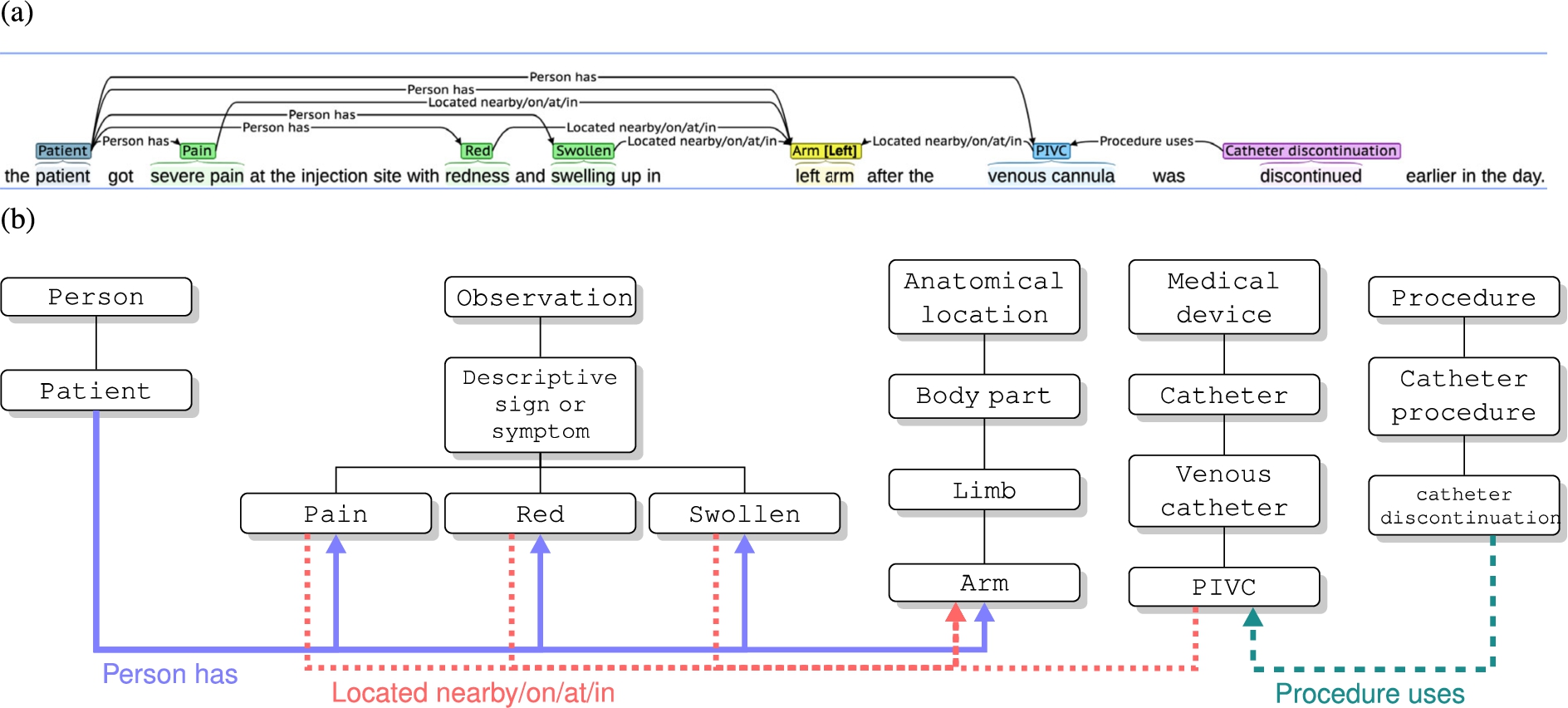 Annotated Adverse Event NOte TErminology (AAENOTE) representing an annotated document. (a) Example of an annotated document with annotation categories and relationships that link the categories together. (b) Part of the terminology class hierarchies used within the annotation example are shown in the white boxes. The 3 annotated relationships (i.e., →Person has, →Located nearby/on/at/in, and →Procedure uses) are represented by the 3 object properties that link the classes together. Object properties are shown using the thicker colored lines with arrows.