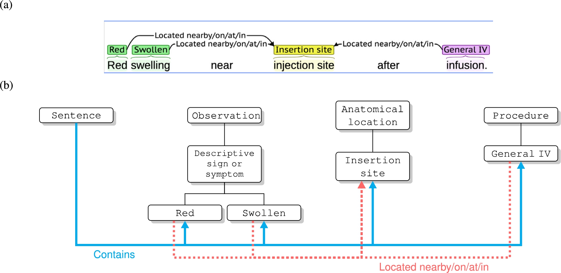 Catheter Infection Indications Ontology (CIIO) clinical knowledge representation. (a) A sentence from a document used to identify documented clinical knowledge. Annotations are based on terms from the Annotated Adverse Event NOte TErminology (AAENOTE). (b) CIIO has a Sentence class and →Contains relationship to link a sentence to documented observable patient states (i.e., AAENOTE terms). AAENOTE terms were used in CIIO to conceptualize the classes and object properties that represent documented knowledge and can be used in reasoning to identify catheters and infections. Part of the ontology class hierarchies and object properties used in knowledge representation are shown. Classes are in white boxes and object properties are shown using thicker colored lines with arrows.