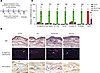 Topical calcipotriol inhibits the IL-23/IL-17 axis and neutrophilia in Alda