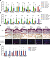 Keratinocytic VDR mediates the inhibition of IL-23/IL-17 and neutrophilia b