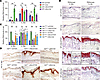 Calcipotriol inhibits IL-36α/γ expression in mouse psoriatic skin epidermis