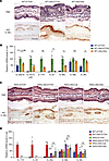 Calcipotriol directly suppresses the expression of IL-36α/γ in mouse skin,