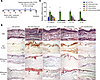 A synergy between calcipotriol and dexamethasone in repressing IL-36α/γ and