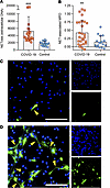 COVID-19 sera trigger control neutrophils to release NETs.