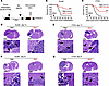 ZIKV extends survival of glioma-bearing mice.