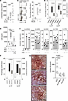 Type I IFN cooperates with IL-22 in the induction of angiogenesis by promot