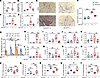 Loss of miR-33 in myeloid cells is protective against bleomycin-induced lun